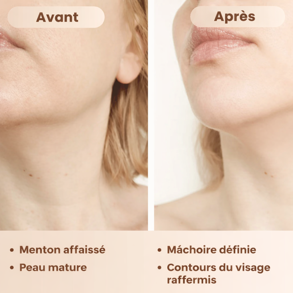 Burelin™ Brosse Lymphatique Visage